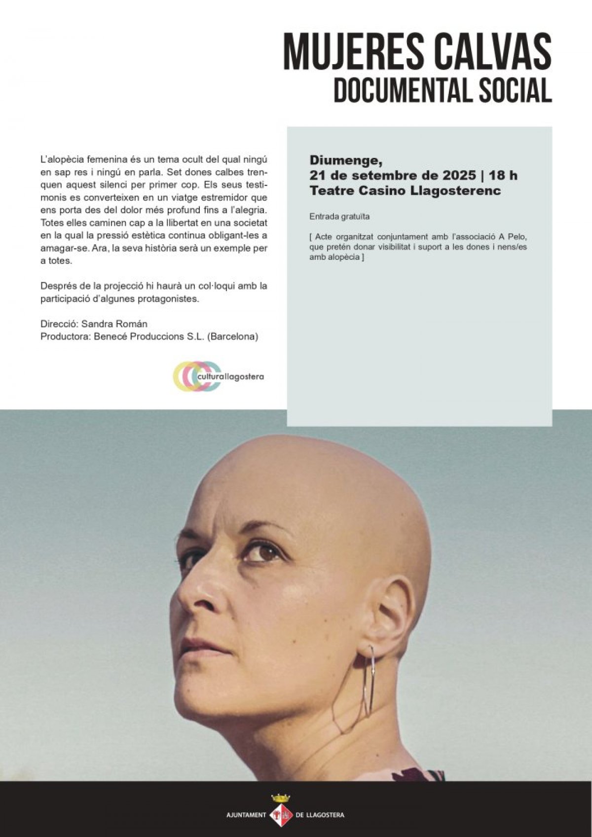 Documental social: Mujeres calvas 
